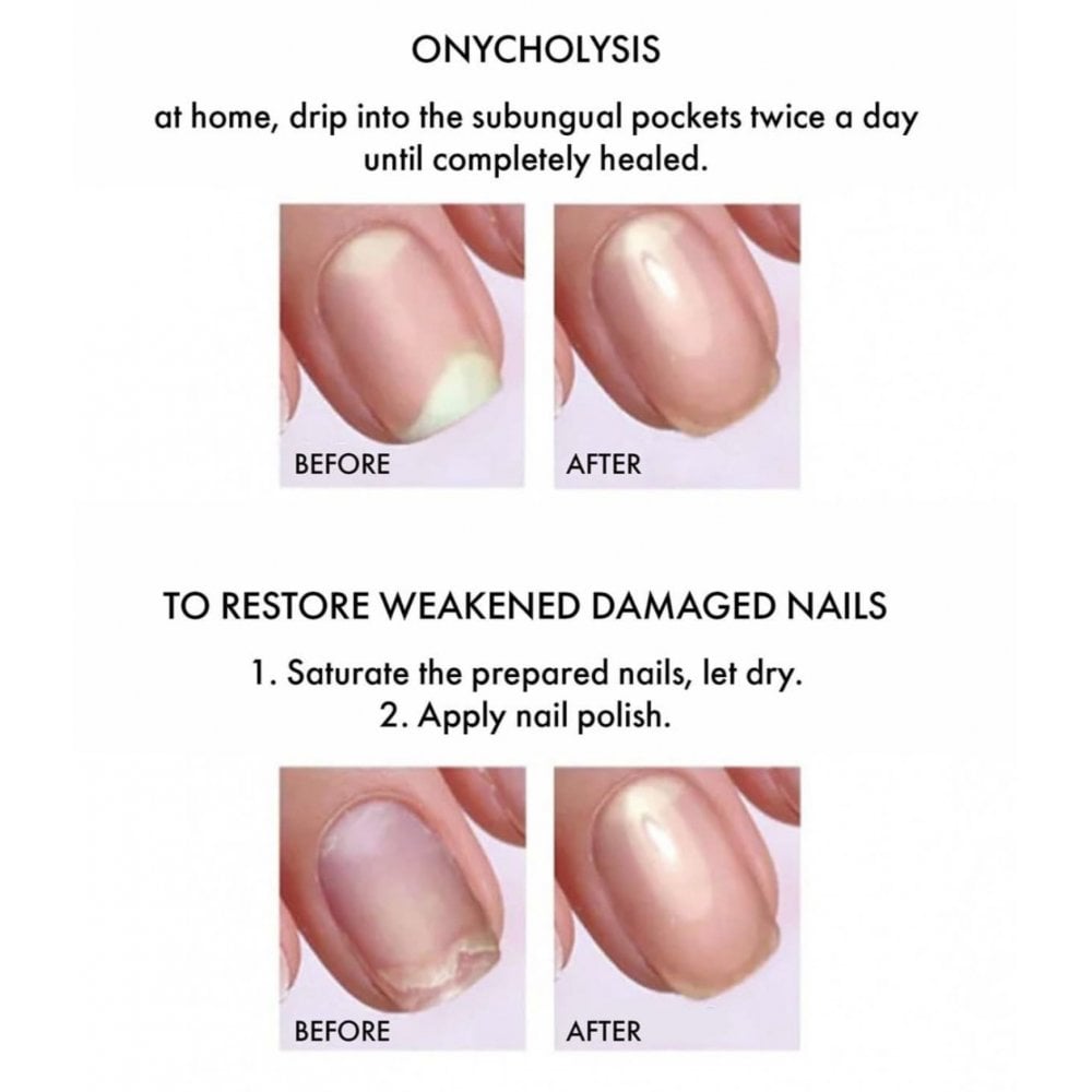 EMI Antifungal – Nail Growth Stimulator - 6ml